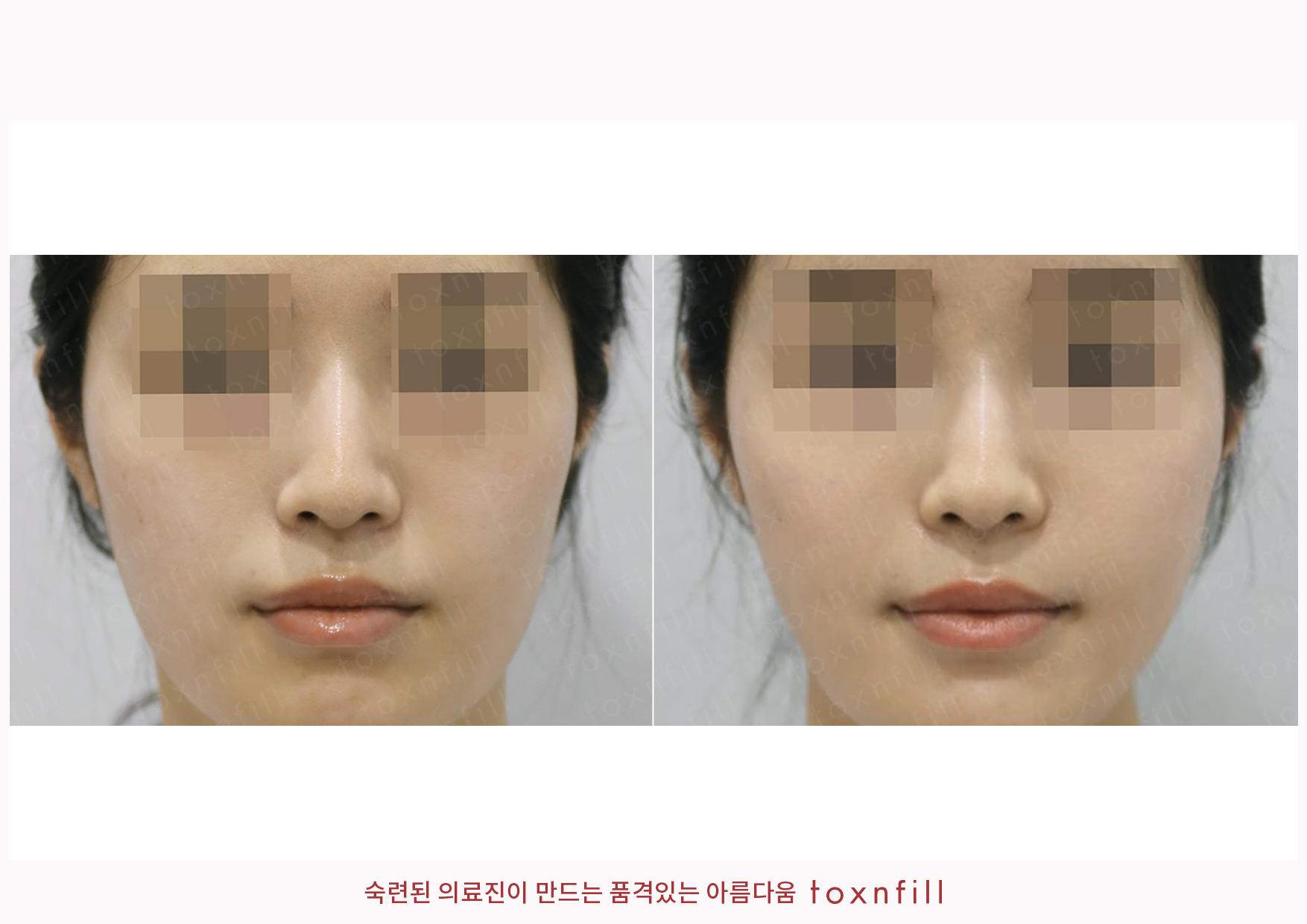 후기 1