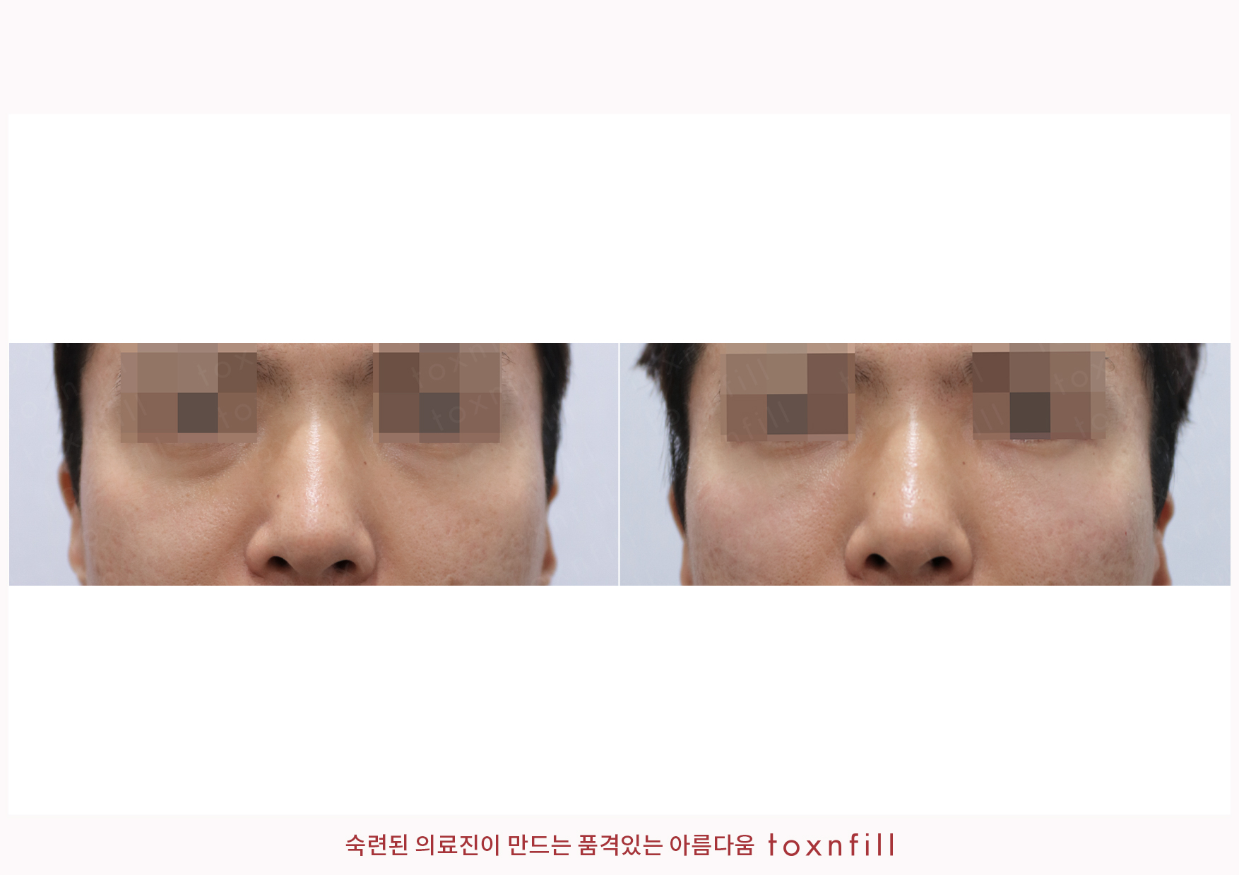 후기 10
