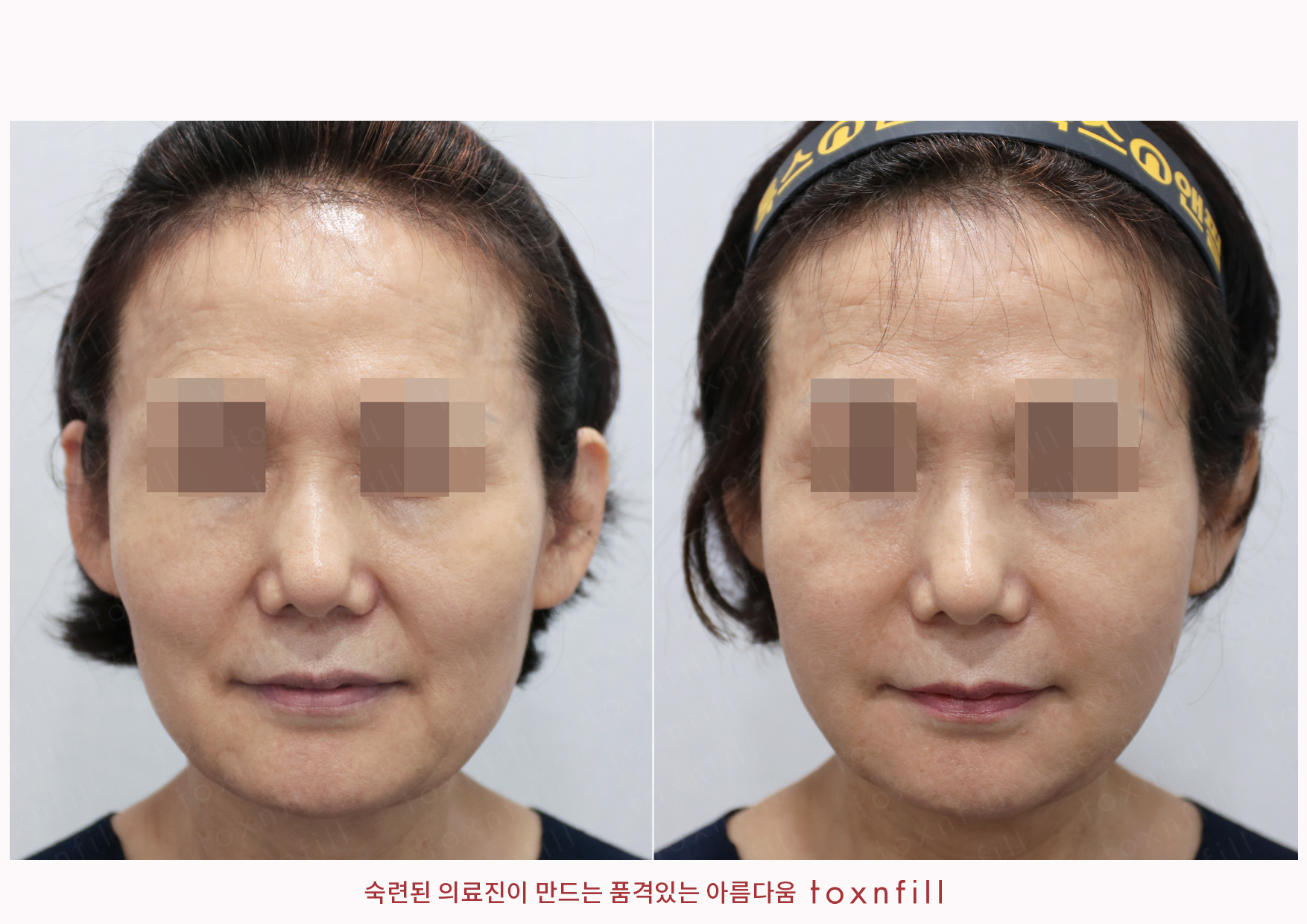 후기 11
