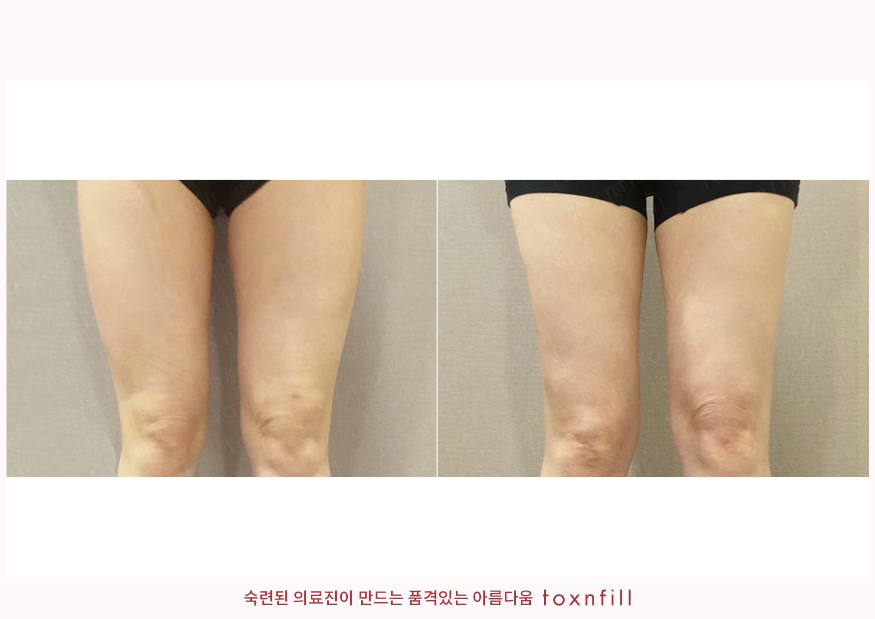 후기 3