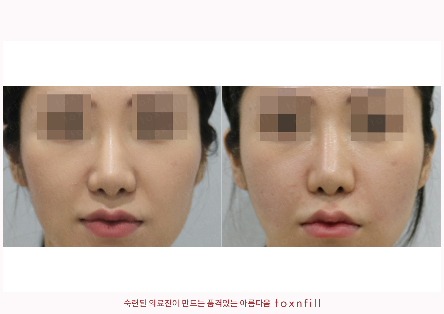 후기 6