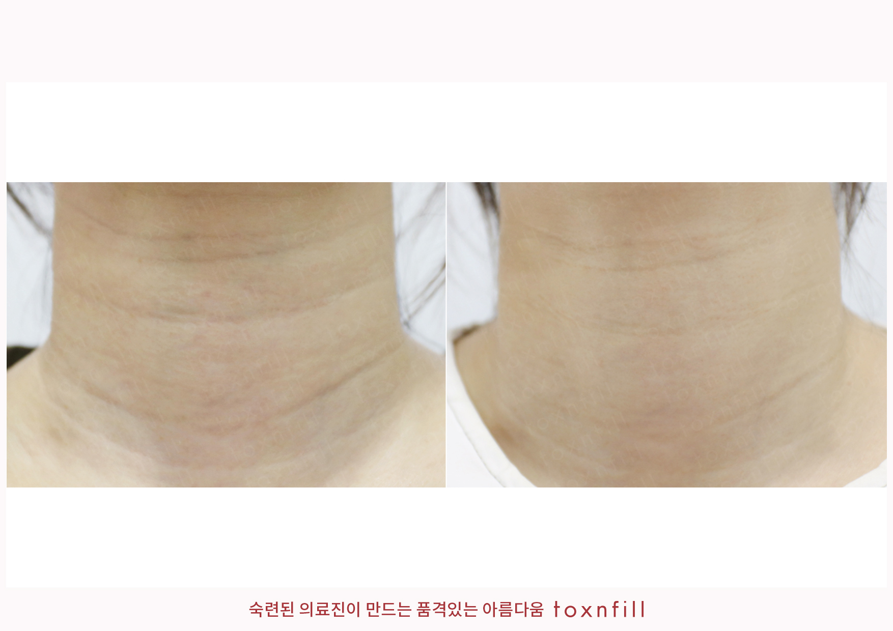후기 4