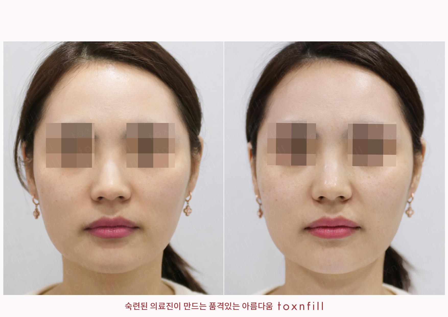 후기 7