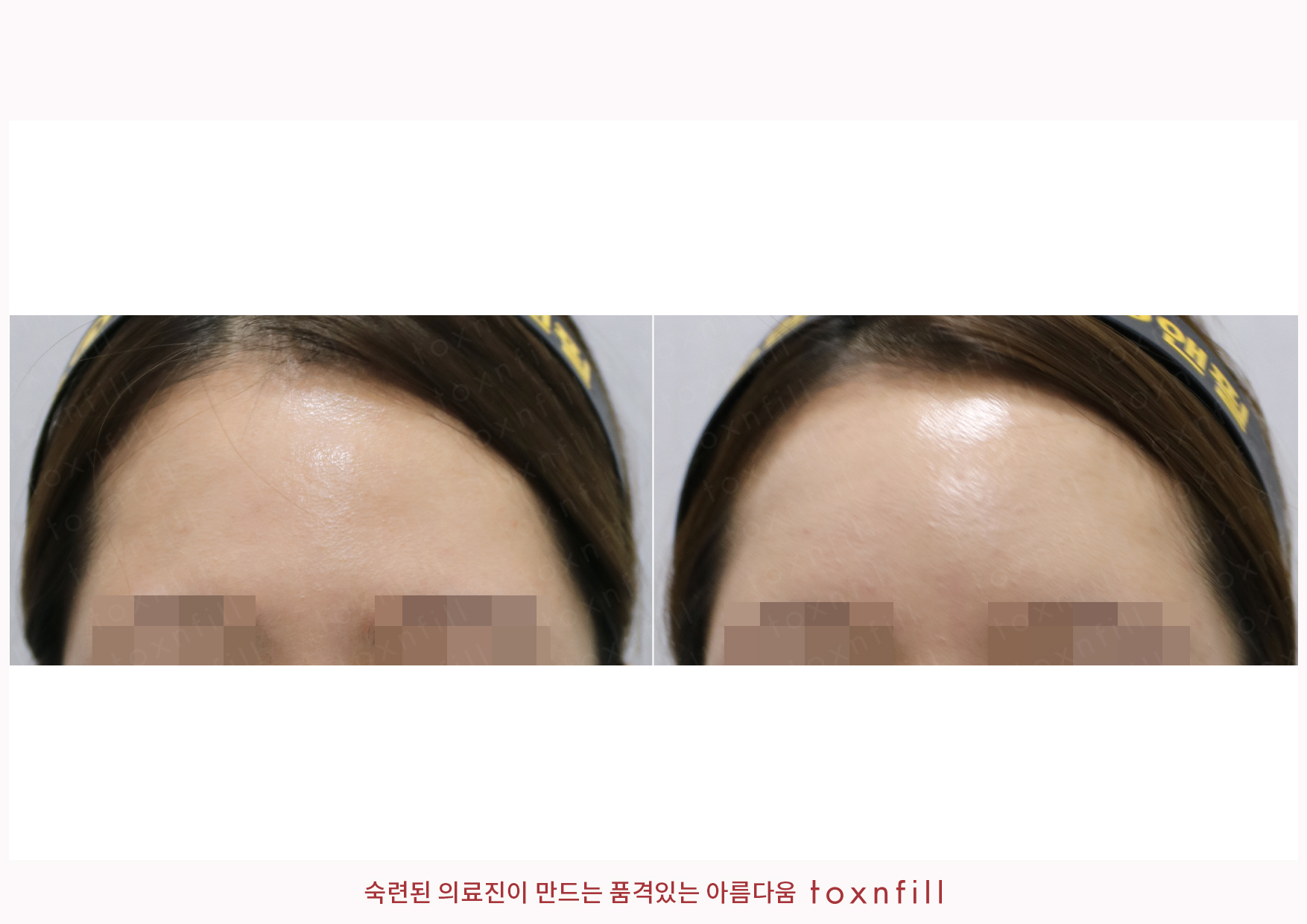 후기 8