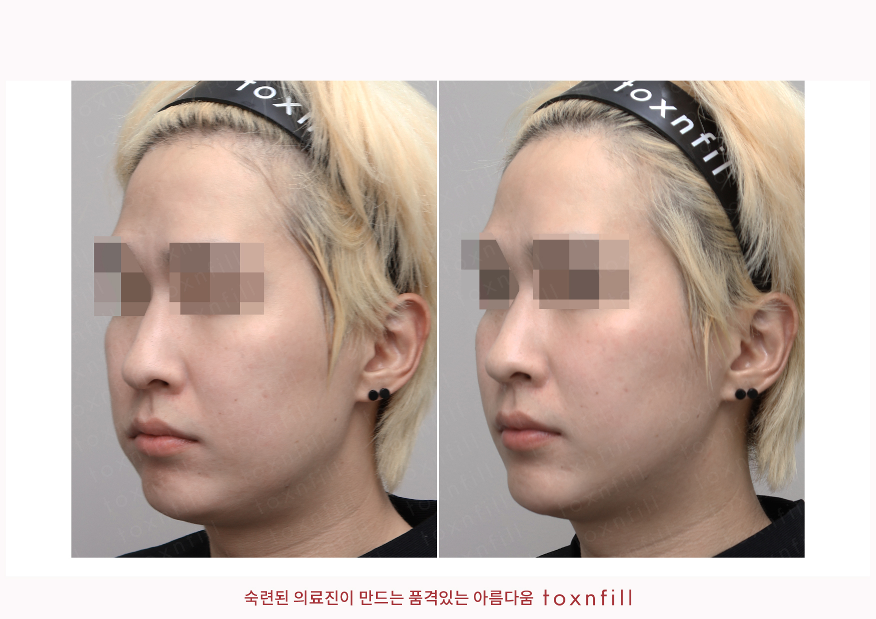 후기 1
