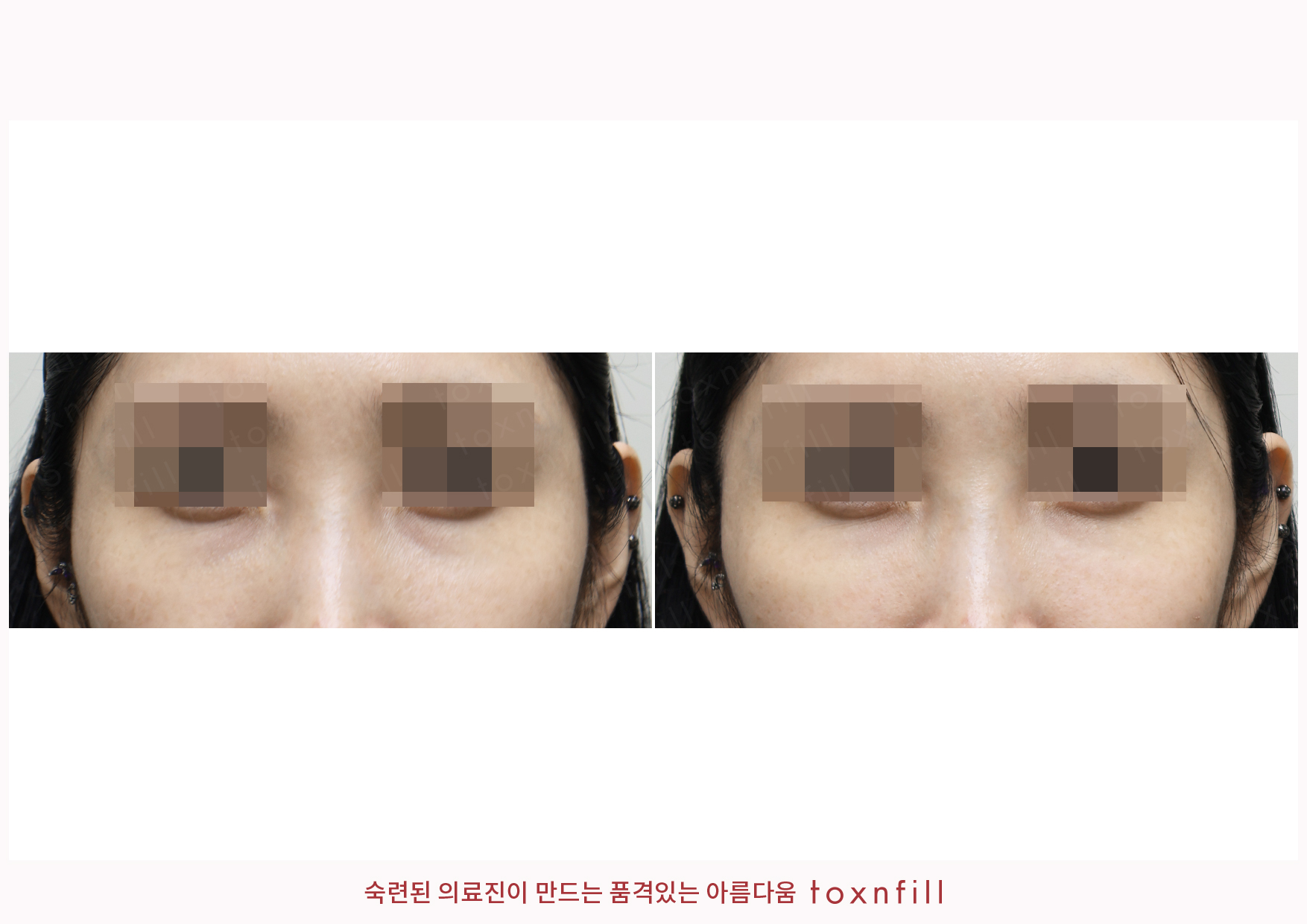 후기 2