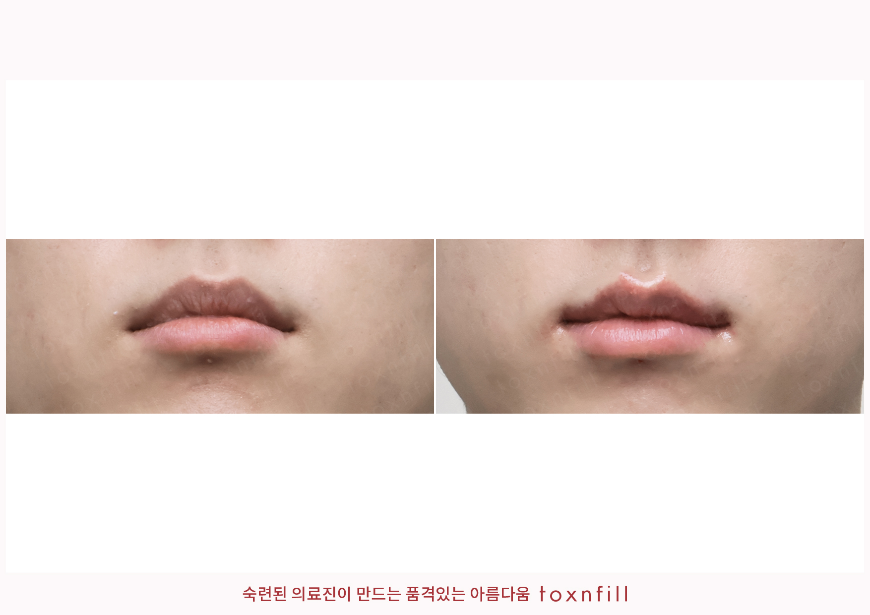 후기 3