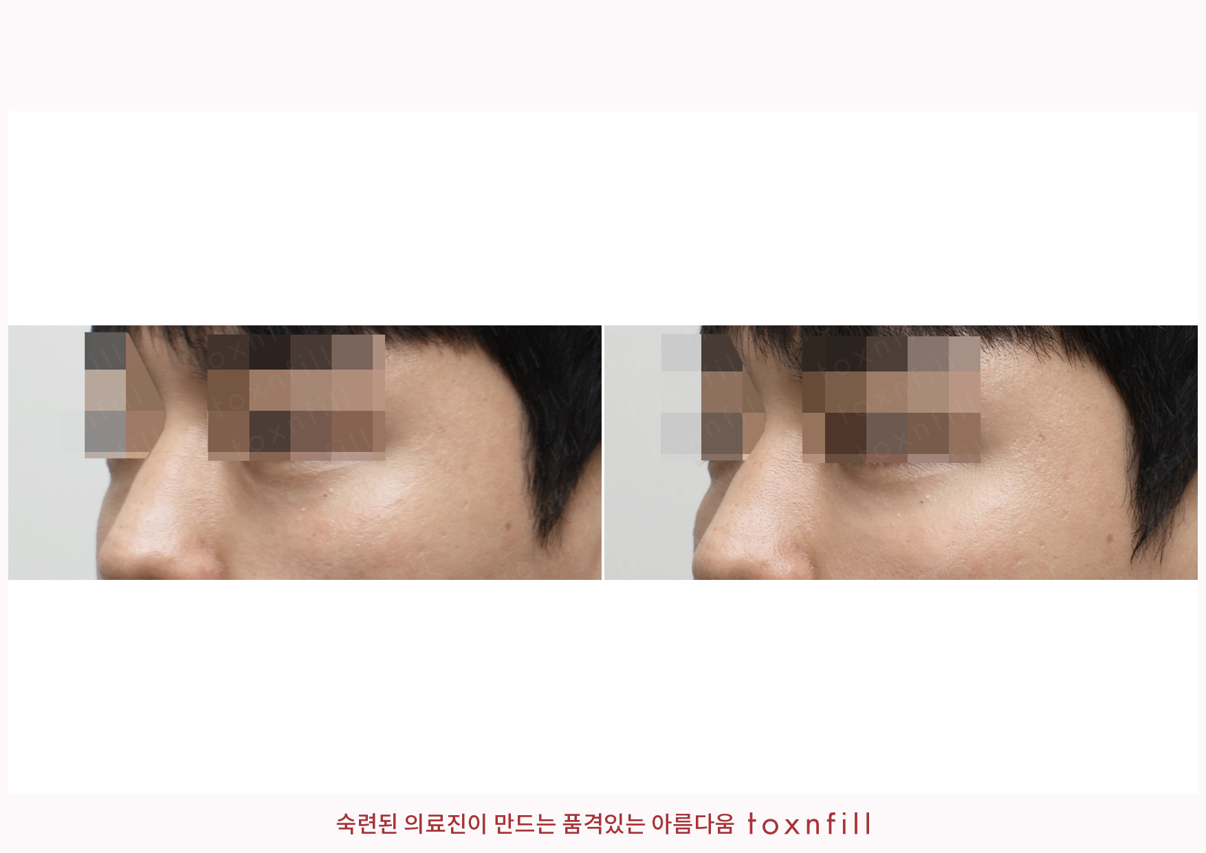 후기 4