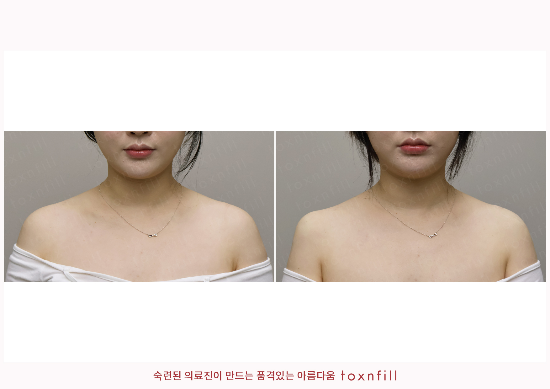후기 5