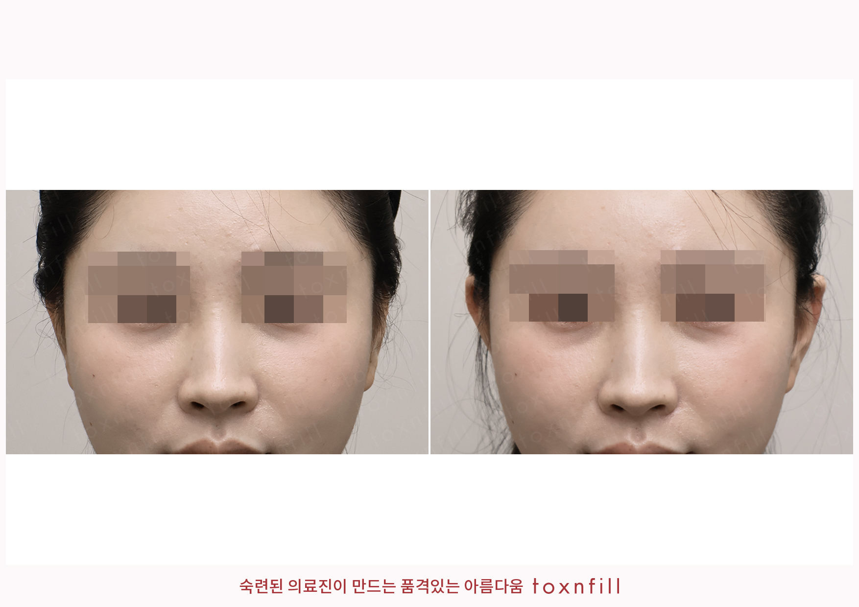 후기 6