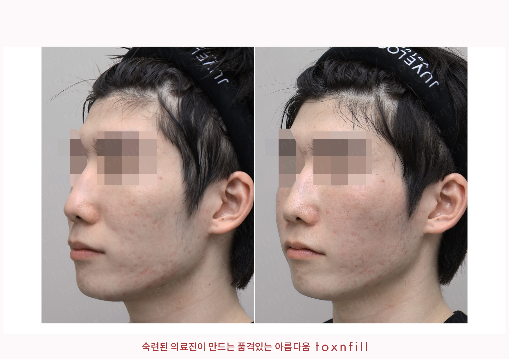 후기 7